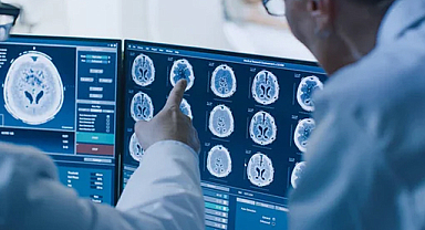 Genetik kodda gizli tehlike: Erkeklerde demans riski yükseliyor