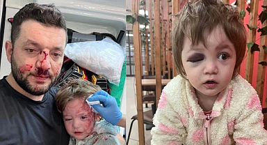 Yalova’da dehşet; Baba ve kızı darp edildi!