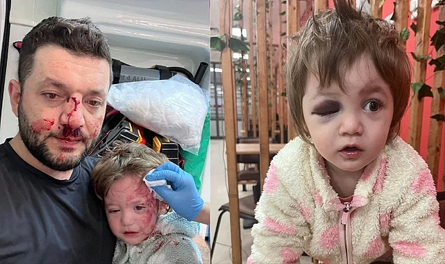 Yalova’da dehşet; Baba ve kızı darp edildi!