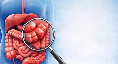 Kolorektal kanserde erken tanı ve ücretsiz tarama