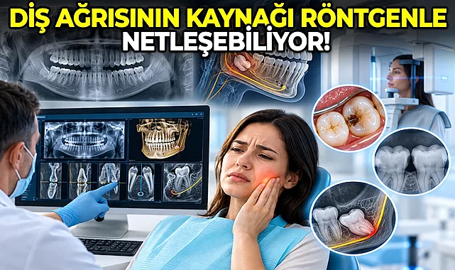 Diş Ağrısının Kaynağı Röntgenle Netleşebiliyor!